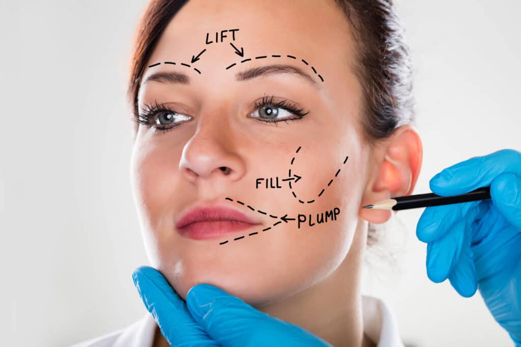 Harmonizacao facial estetica facial em Fortaleza 2