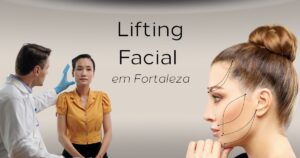 Lifting Facial em Fortaleza harmonizacao facial ceara. 4 Grande