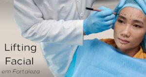 Lifting Facial em Fortaleza harmonizacao facial ceara. Grande