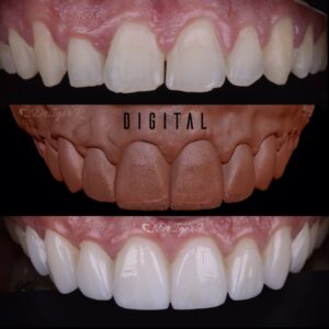 Scopri di più sull'articolo Odontologia Digital: o melhor para Dentista e Paciente