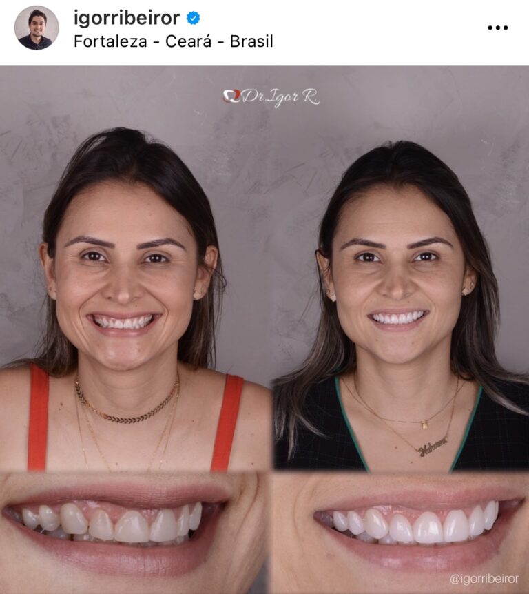 Dr Igor Ribeiro — Dentiste CRO-CE 9062 Clinique IBR Fortaleza