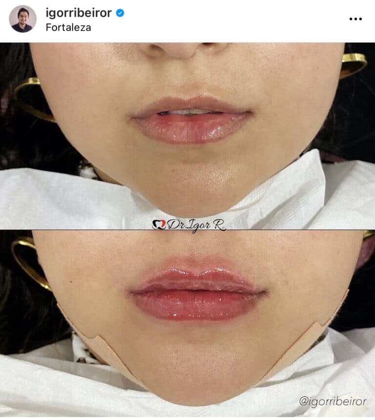 Dr Igor Ribeiro — Dentiste CRO-CE 9062 Clinique IBR Fortaleza