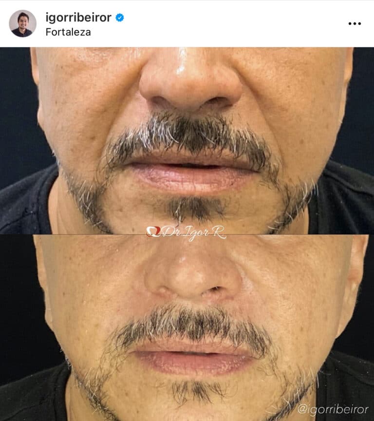 Dr Igor Ribeiro — Dentiste CRO-CE 9062 Clinique IBR Fortaleza