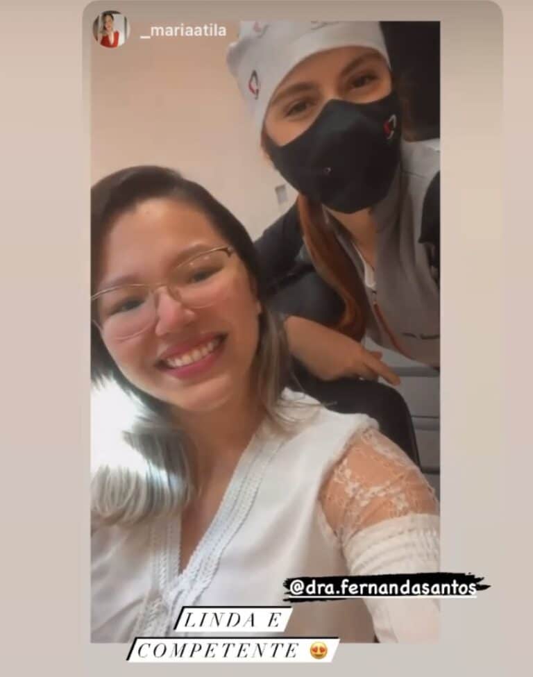 Facetas em Resina 13 Dr Igor Ribeiro — Dentiste CRO-CE 9062 Clinique IBR Fortaleza