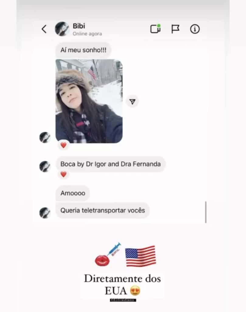 Facetas em Resina 14 Dr Igor Ribeiro — Dentiste CRO-CE 9062 Clinique IBR Fortaleza