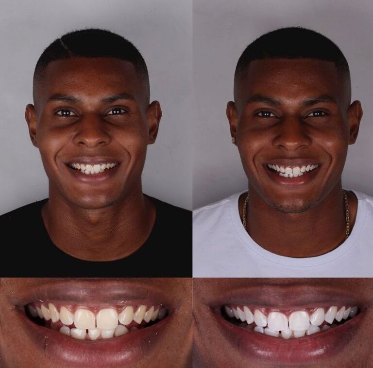 Dr Igor Ribeiro — Dentiste CRO-CE 9062 Clinique IBR Fortaleza