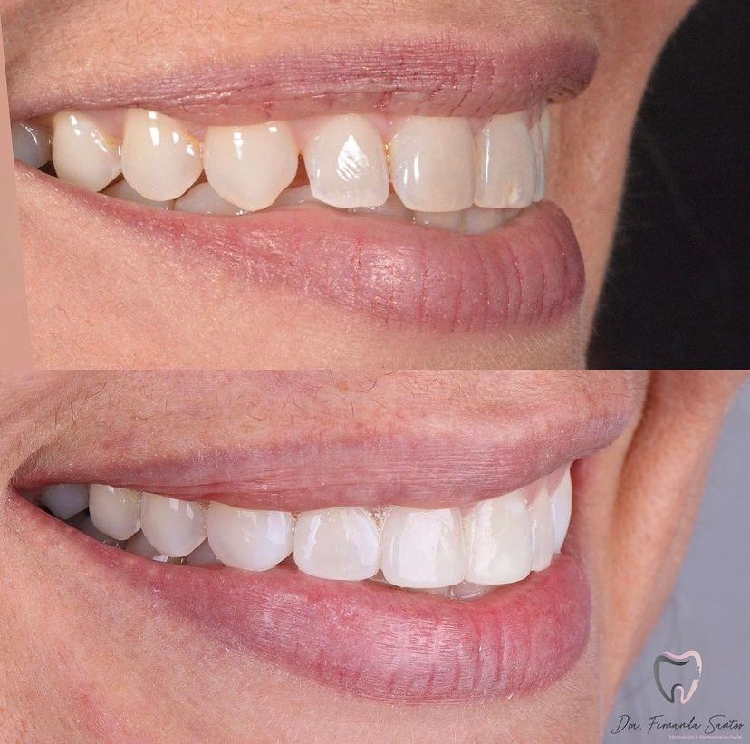 Dr Igor Ribeiro — Dentiste CRO-CE 9062 Clinique IBR Fortaleza