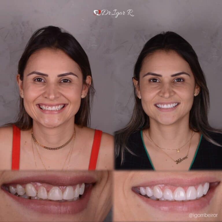 Dr Igor Ribeiro — Dentiste CRO-CE 9062 Clinique IBR Fortaleza
