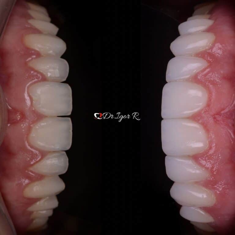 Dr Igor Ribeiro — Dentiste CRO-CE 9062 Clinique IBR Fortaleza