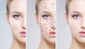 Leer más sobre el artículo Descubra os tratamentos de Estética Dental e Harmonização Facial que podem ser realizados com um Dentista em Fortaleza