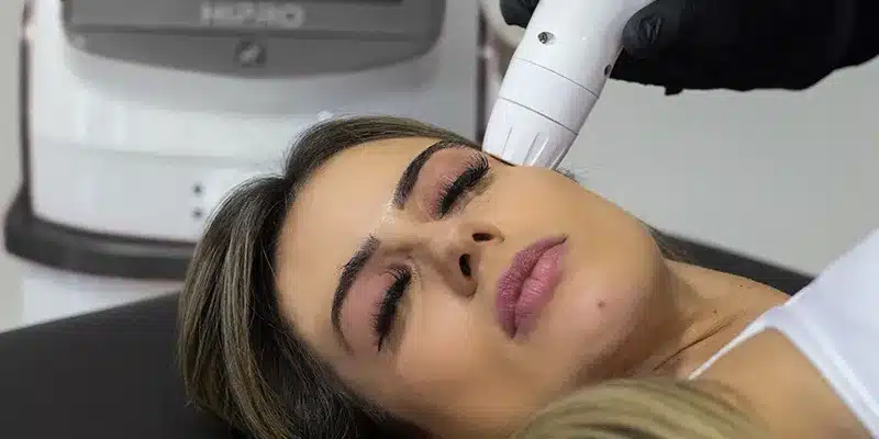 Ultrassom microfocado em Fortaleza — IBR Clinic | Dr. Igor Ribeiro