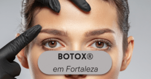 Scopri di più sull'articolo Botox em Fortaleza Perto de Mim
