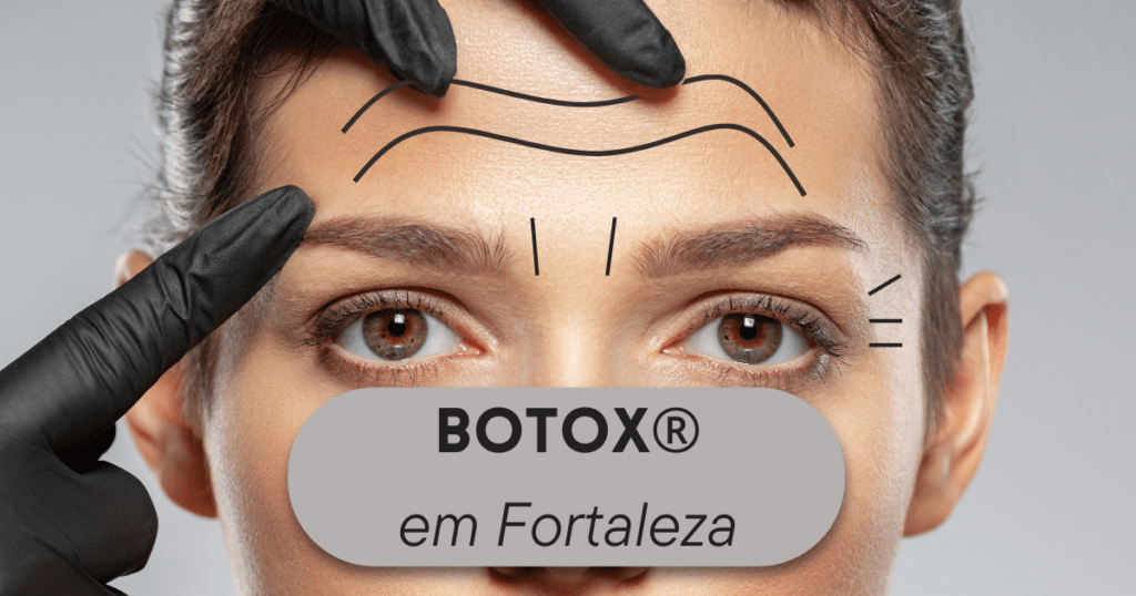Botox em Fortaleza, Remoção de Rugas com Botox