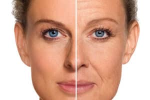 Leia mais sobre o artigo Descubra como Transformar Sua Pele em na Clínica Estética em Fortaleza
