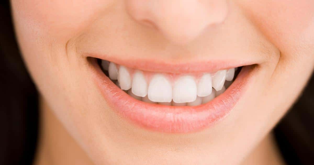 Read more about the article Como fazer prótese dentária em Fortaleza de forma eficiente