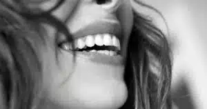 Leia mais sobre o artigo Dente de resina: descubra a solução moderna para seu sorriso