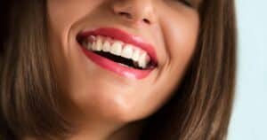 Leia mais sobre o artigo Endodontia em Fortaleza: Tudo o que você precisa saber