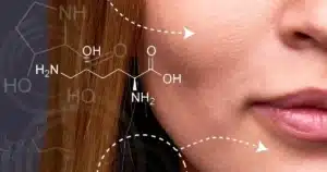 Leer más sobre el artículo Botox preventivo: saiba como evitar rugas