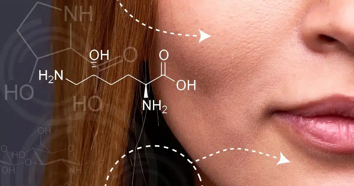 Leer más sobre el artículo Botox preventivo: saiba como evitar rugas