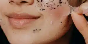 Scopri di più sull'articolo Peeling: tudo sobre o procedimento estético
