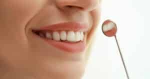Leia mais sobre o artigo Profilaxia Dental Fortaleza: Dicas para uma Limpeza Eficiente