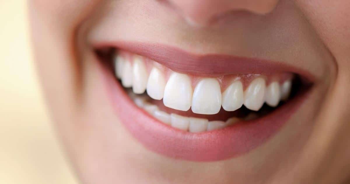 Read more about the article Restauração Dental Fortaleza: Sorria com Confiança!