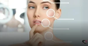 Lire la suite à propos de l’article Resultados Potencializados com Botox e Cirurgia Plástica