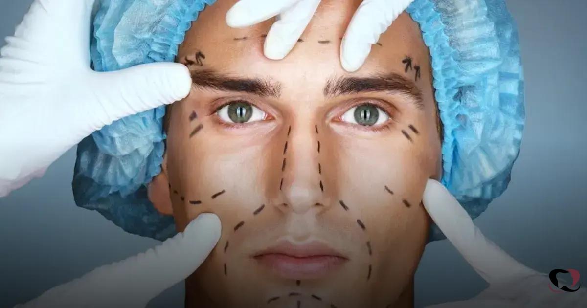 botox preventivo vale a pena?