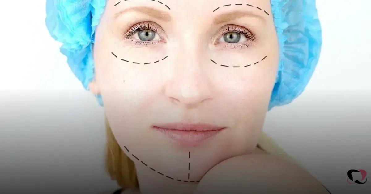 botox preventivo valor