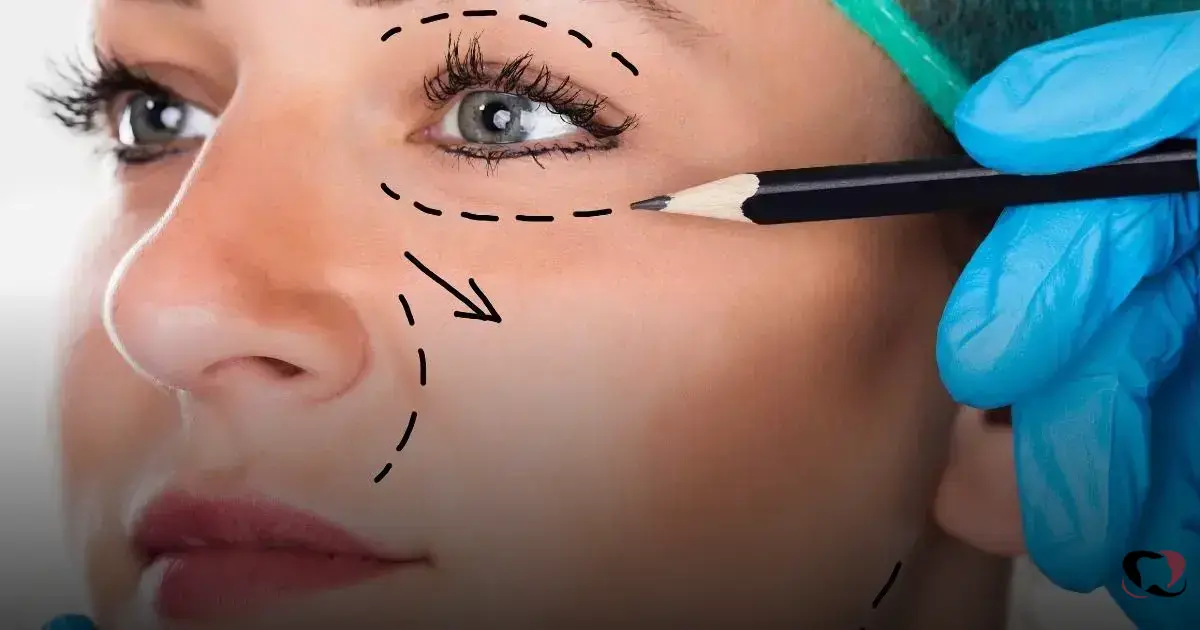 Read more about the article Botox Preventivo: 7 Dicas Eficazes para Reduzir Rugas