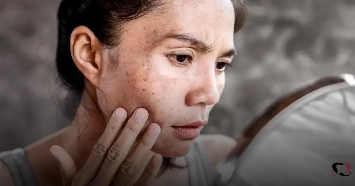 How Botox Enhances Plastic Surgery Results