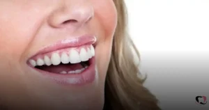 Leia mais sobre o artigo Impactação dos Dentes do Siso e a Importância da Extração
