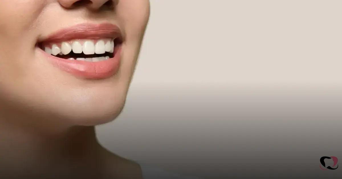 Dicas para um Sorriso Impecável