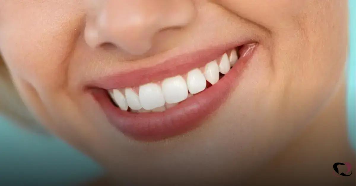 Entenda a Impactação dos Dentes do Siso