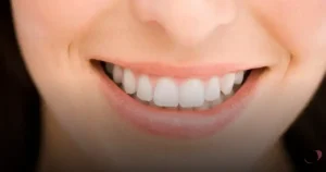 Read more about the article Renovação Estética com Facetas em Resina