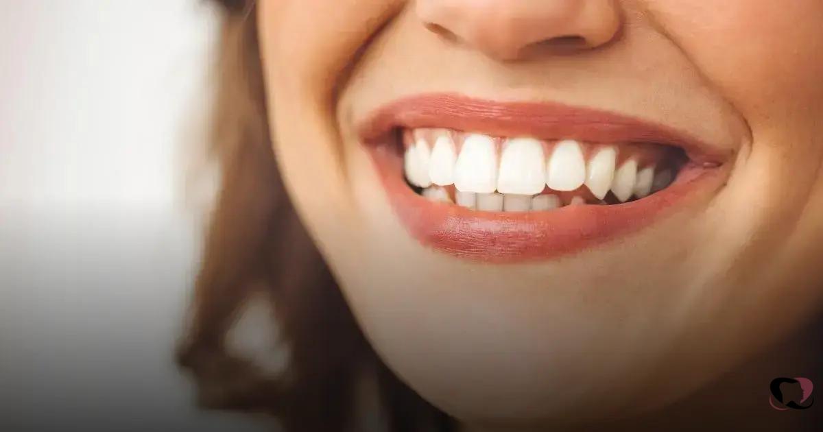 O que é Aparelho Invisível O que é Aparelho Invisível