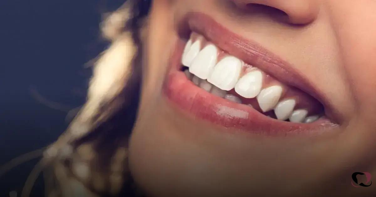 Dental Braces Options Dental Braces Options