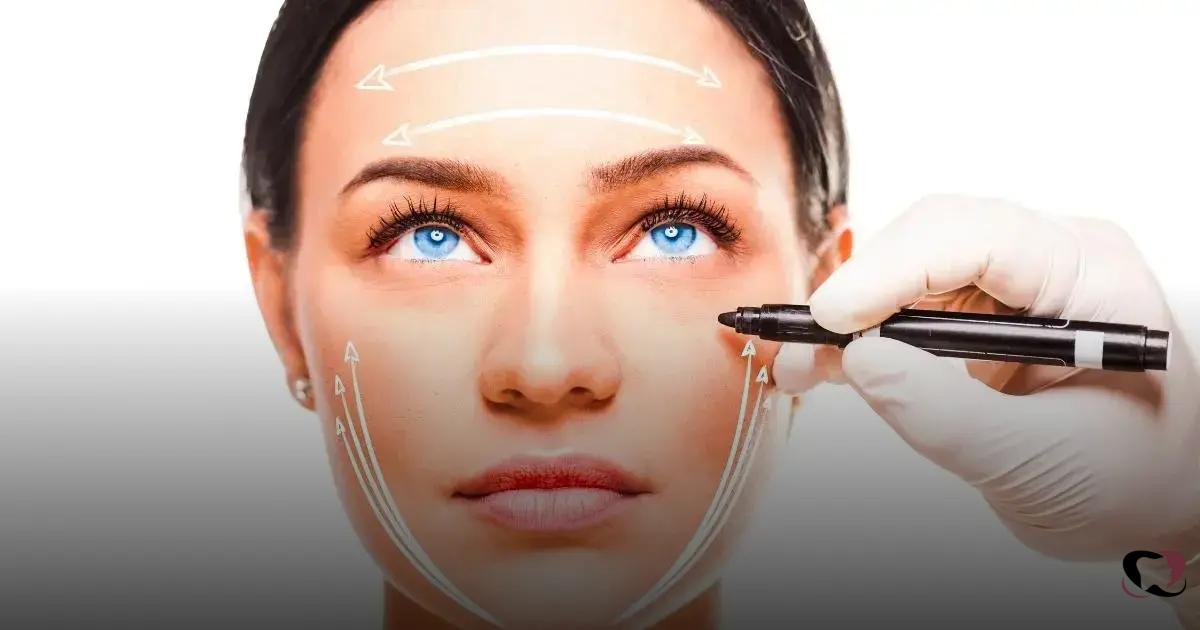 Beneficios del Botox en la Armonización Facial