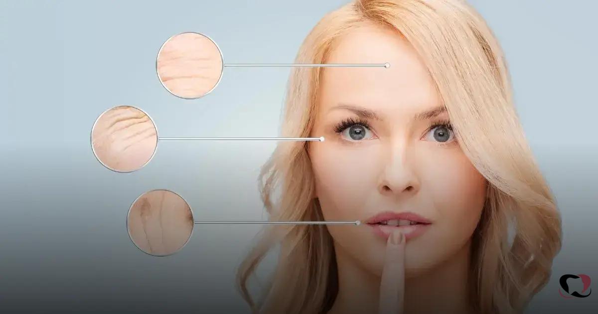 Benefícios do Preenchimento Labial