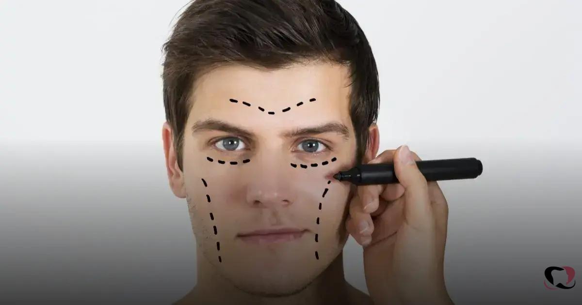 What is Jaw Filling?