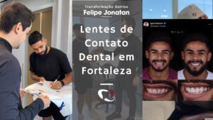 Scopri di più sull'articolo Transformação de Sorriso com Lentes Dentais: Felipe Jonatan do Fortaleza EC | Dr. Igor Ribeiro