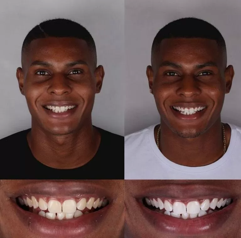 Dr. Igor Ribeiro — Cirurgião-Dentista CRO-CE 9062 IBR Clinic Fortaleza