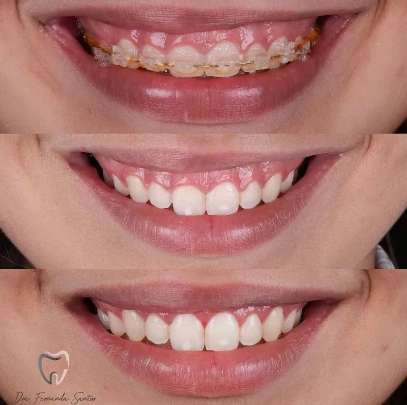 Dr. Igor Ribeiro — Dentist CRO-CE 9062 IBR Clinic Fortaleza