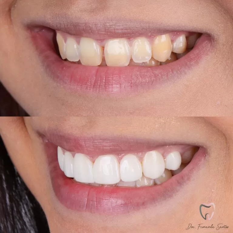 Dr. Igor Ribeiro — Dentist CRO-CE 9062 IBR Clinic Fortaleza