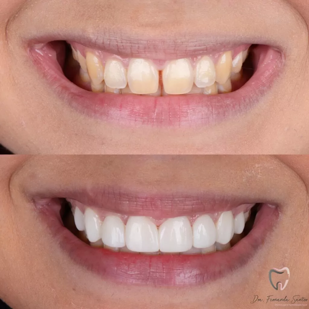 Dr. Igor Ribeiro — Dentist CRO-CE 9062 IBR Clinic Fortaleza