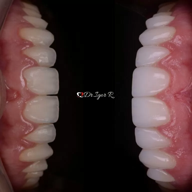 Dr. Igor Ribeiro — Cirurgião-Dentista CRO-CE 9062 IBR Clinic Fortaleza