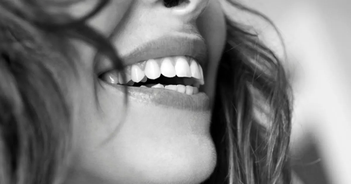 Leer más sobre el artículo Dente de resina: descubra a solução moderna para seu sorriso