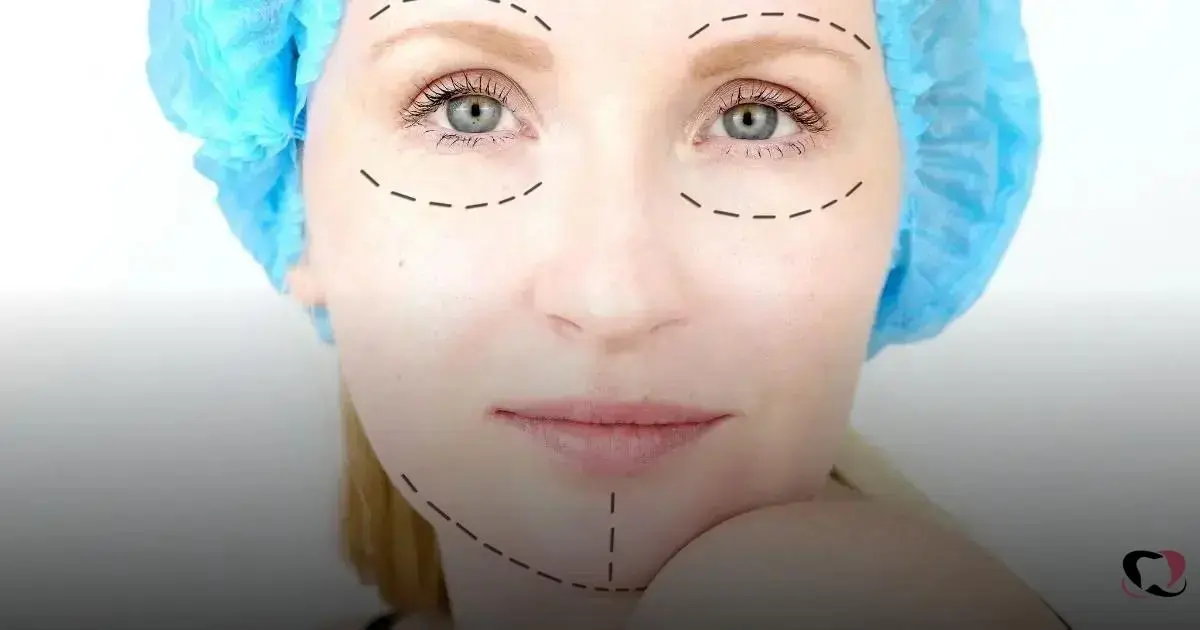 preventive botox value preventive botox value